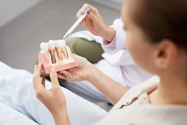 Dental Implants in Dubai